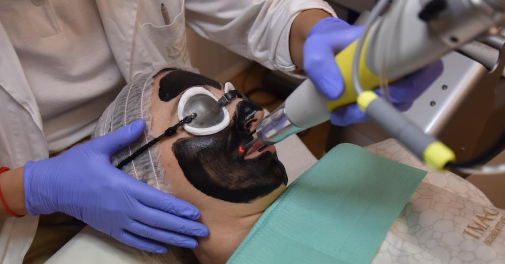 New: Carbon Peel Laser