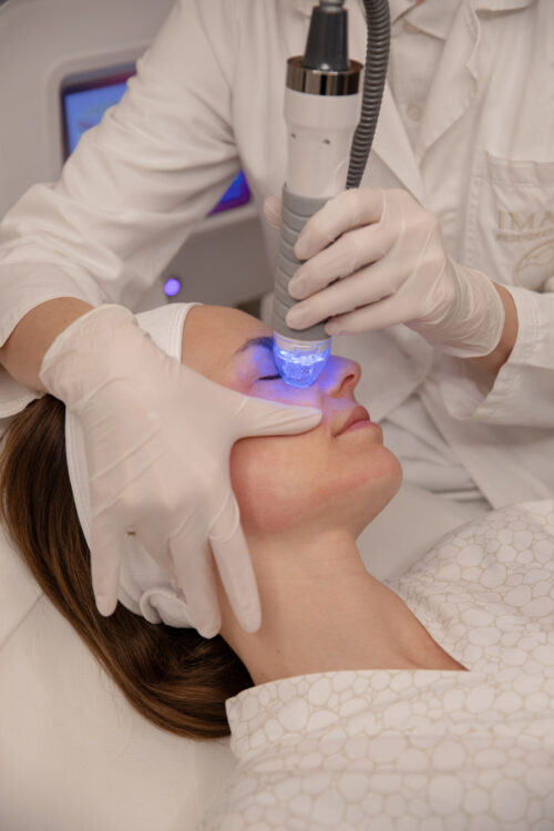 Vivace: Radiofrequency with Regenerative Microneedles